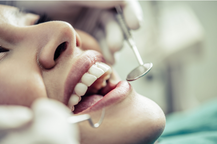 Best Dental Insurance for Implants: What Patients Should Know Before Enrolling
